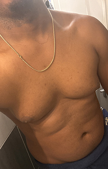 Blackboy